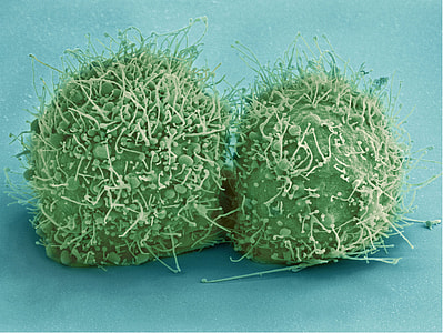 closeup photography of seeds thumbnail