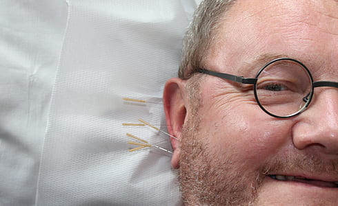 needles on person's ear thumbnail