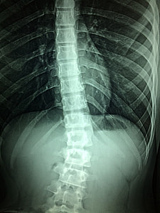 radiograph result thumbnail