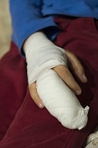 person wearing white hand cast thumbnail