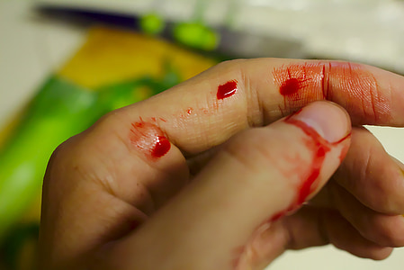 left human hand with blood thumbnail