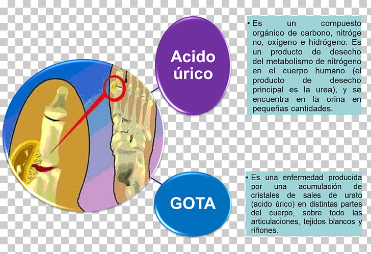 acumulación de orina
