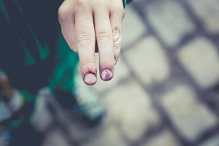 person's finger with blood thumbnail