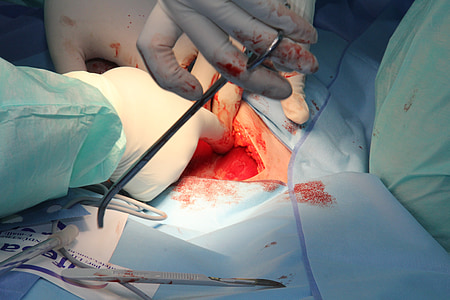surgical operation thumbnail