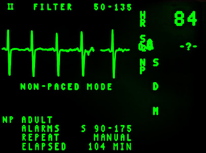 heart beat reading at 84 thumbnail