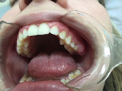 women's mouth thumbnail