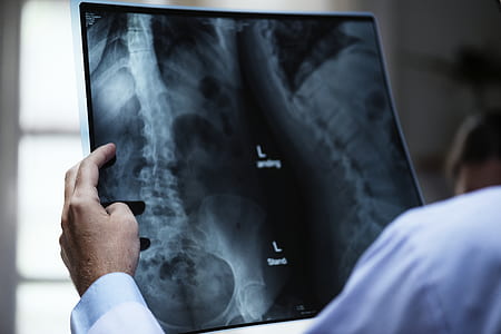 person holding x-ray result thumbnail