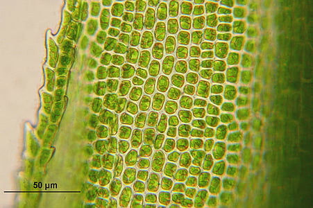 microscopic photo of green bacteria thumbnail