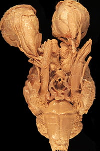 human brain thumbnail