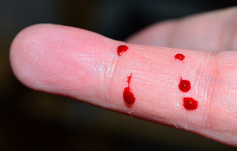blood on finger thumbnail