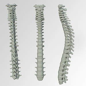 spinal cord bone collage thumbnail