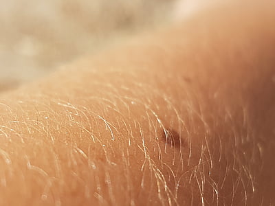 macro photography of human skin thumbnail