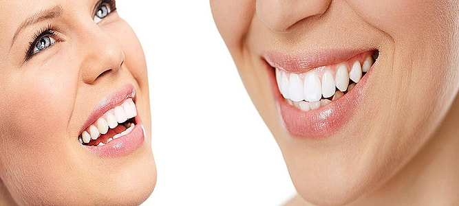 closeup photo of woman smiling thumbnail