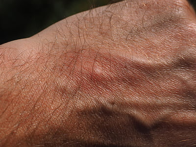 person's fist thumbnail