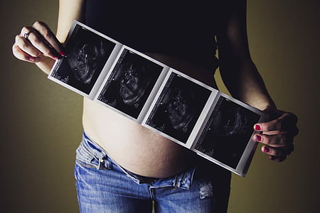 Sonogram thumbnail