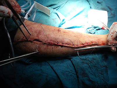 person having a arm surgery thumbnail