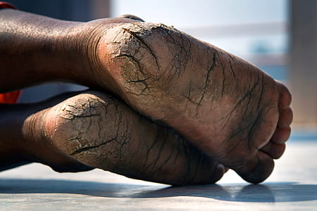selective focus photography of person's feet thumbnail