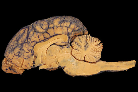 brown brain illustration thumbnail