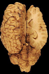 human brain thumbnail