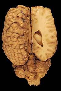 human brain wallpaper thumbnail