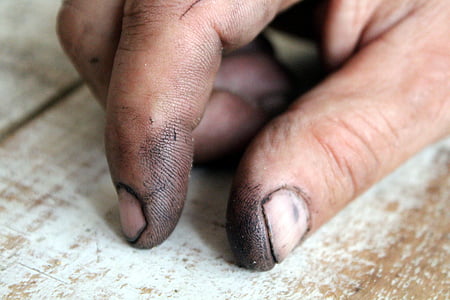 person's right hand thumbnail