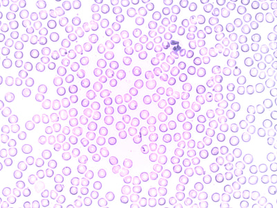 purple bubbles thumbnail