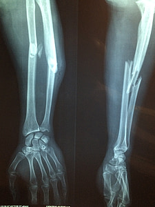 x-ray result thumbnail