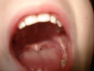 person's open mouth thumbnail