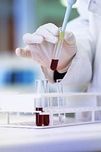 tilt shift lens photography of clear glass test tube with red liquid inside thumbnail
