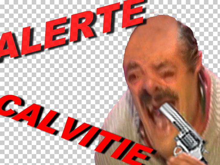 El Risitas Sticker Issou Hair Loss Issou Png Clipart Free