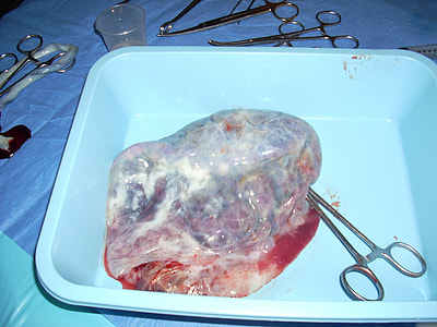 gray cutting shear on blue plastic container thumbnail