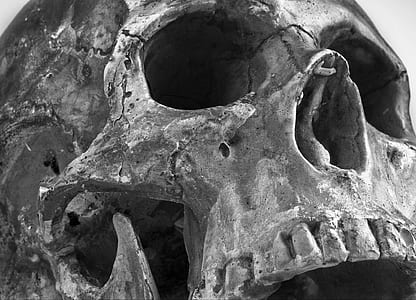 grayscale photo of human skull thumbnail