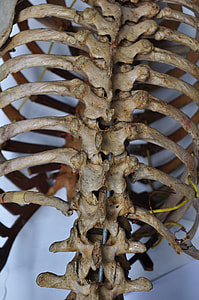 photo of human's spinal column thumbnail