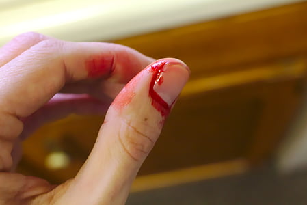 close-up photography of fingernail with blood thumbnail