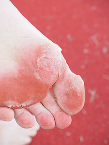 human skin condition thumbnail