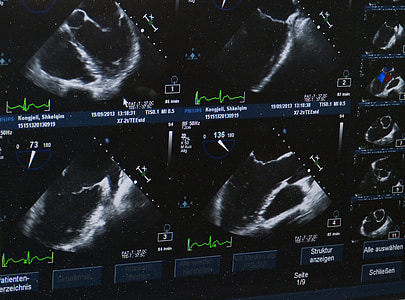 CT scan result thumbnail