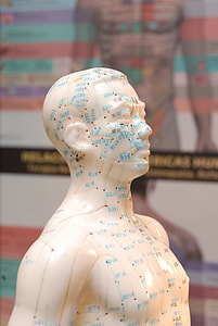 Acupuncture, Medicine Alternative thumbnail