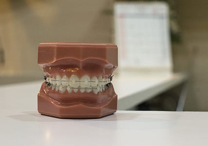 white and brown dental ceramic figurine thumbnail
