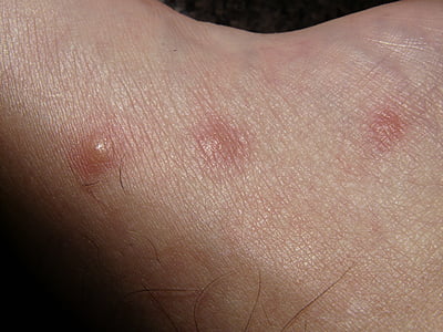 person's skin condition thumbnail