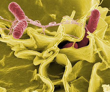 microbial photo thumbnail