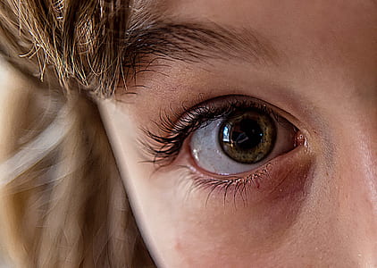 human right eye thumbnail