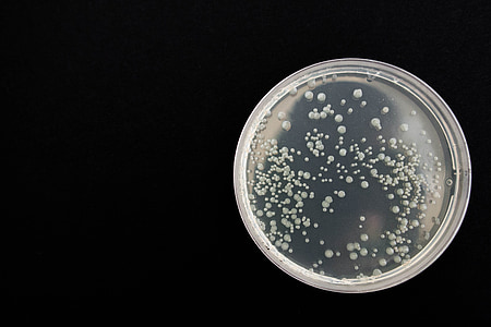 bacteria, black, health, microbiology, infection, cell thumbnail