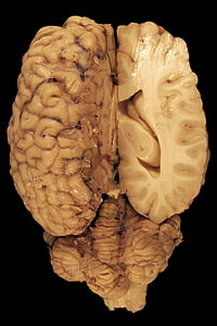 brain illustration thumbnail