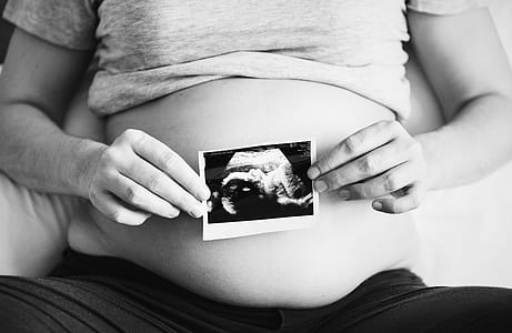 Grayscale Photography of Woman Holding Ultrasound Photo thumbnail