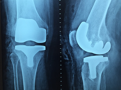 knee x-ray result thumbnail